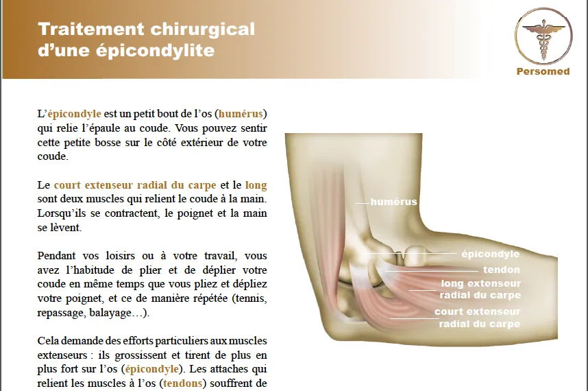 Livret traitement chirurgical d’une épicondylite