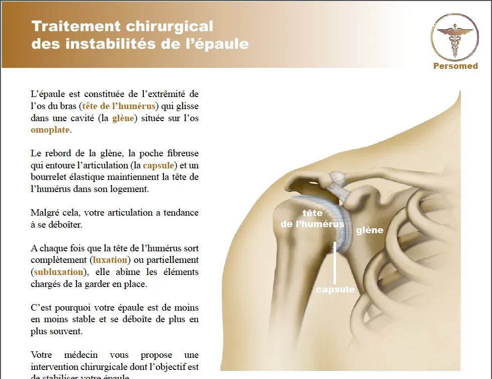 Livret traitement chirurgical des instabilités de l’épaule